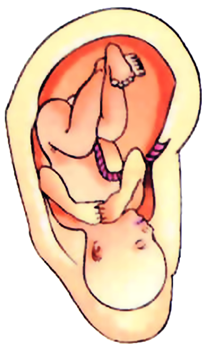 Inverted fetus shape represented and explained by the auricular medicine theory